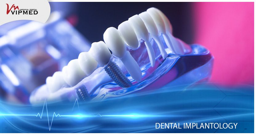 Dental Implantology