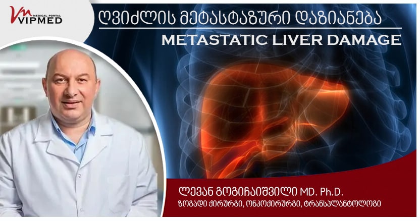 gvidzlis-metastazuri-dazianebebi