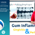 Gingivitis and Periodontitis