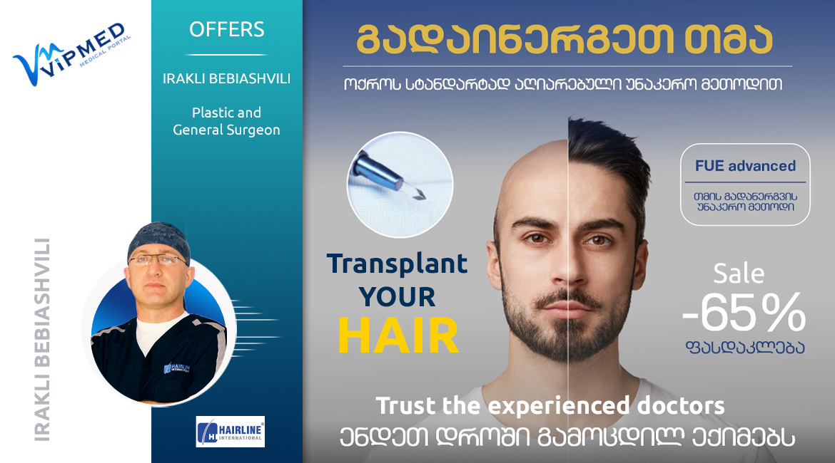 Hair Transplantation